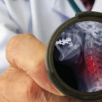 Blog Image - Cell Repair Technology at QiSpine Clinic