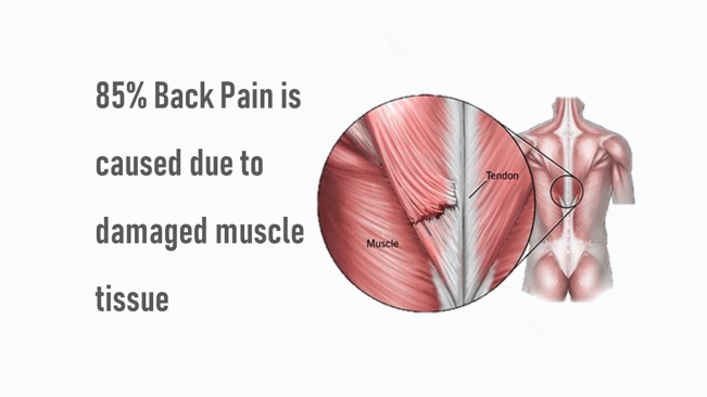 Condition Back Pain Symptom