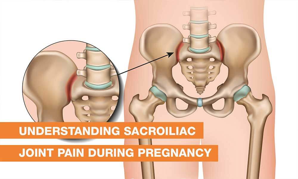 Blog Image - Understanding Sacroiliac Joint Pain During Pregnancy