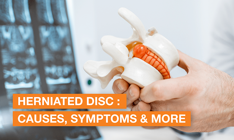 Blog Image - Herniated Disc : Causes, Symptoms & More