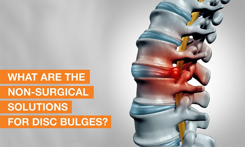 Blog Image - What are the non-surgical solutions for disc bulges?