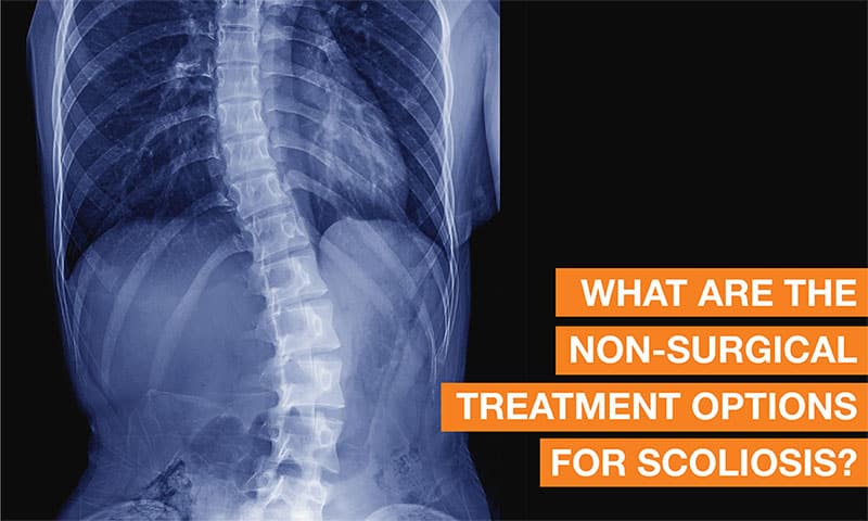 Blog Image - What are the non-surgical solutions for treating scoliosis?