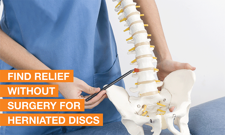 Blog Image - What are the non-surgical options for herniated discs?