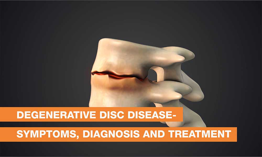 Blog Image - Degenerative Disc Disease- Symptoms, Diagnosis and Treatment