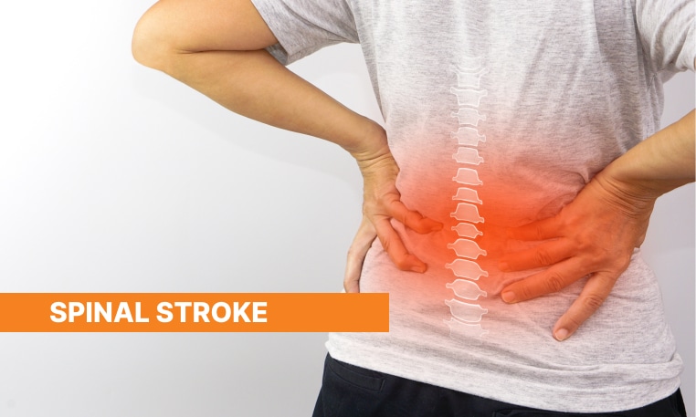 Blog Image - What is Spinal Stroke?