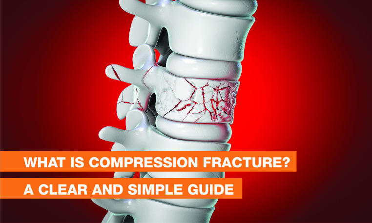 Blog Image - What is Compression Fracture? A Clear and Simple Guide